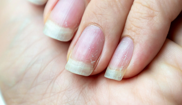 brittle nails,home remedies for brittle nails,how to strengthen brittle nails,causes of brittle nails,brittle nails treatment,natural remedies for brittle nails,weak nails solution,nail care tips,vitamins for brittle nails,diy nail strengthening remedies,how to fix brittle nails,brittle nails and nutrition,best oils for brittle nails,brittle nails home treatment,ways to prevent brittle nails