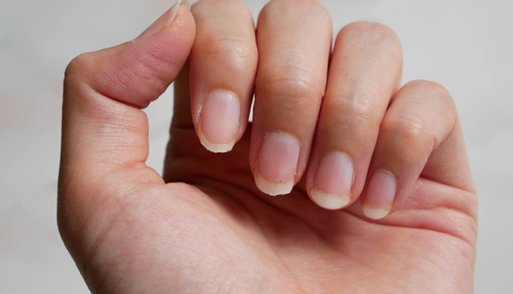 4 Remedies You Can Try To Make Your Brittle Nails Strong