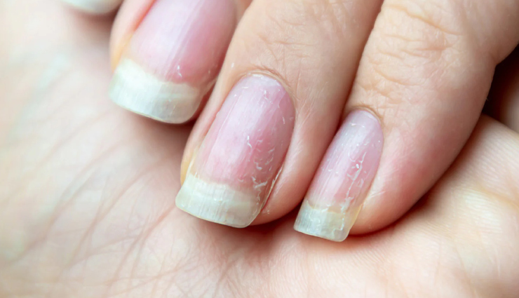 vitamin d deficiency skin problems,effects of low vitamin d on skin,vitamin d and acne breakouts,hair issues from vitamin d deficiency,signs of vitamin d deficiency on skin,vitamin d deficiency and aging,how vitamin d affects nails and skin