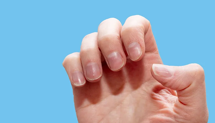 brittle nails,home remedies for brittle nails,how to strengthen brittle nails,causes of brittle nails,brittle nails treatment,natural remedies for brittle nails,weak nails solution,nail care tips,vitamins for brittle nails,diy nail strengthening remedies,how to fix brittle nails,brittle nails and nutrition,best oils for brittle nails,brittle nails home treatment,ways to prevent brittle nails