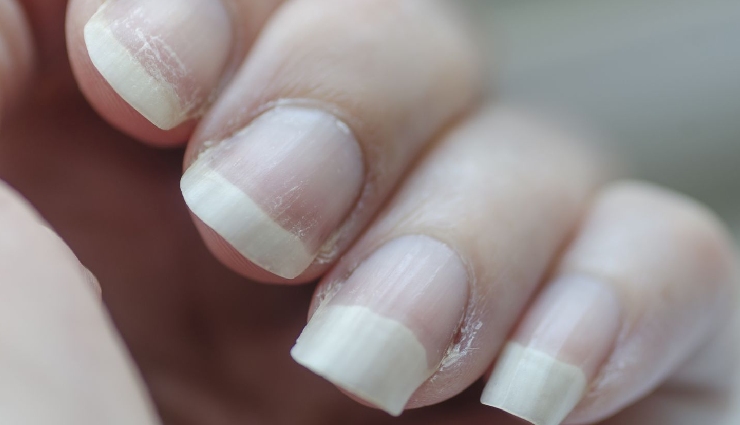 calcium deficiency symptoms,low calcium signs,calcium benefits,weak bones causes,muscle cramps and calcium,osteoporosis risk,daily calcium requirement,calcium for bone health,calcium-rich foods,signs of low calcium levels