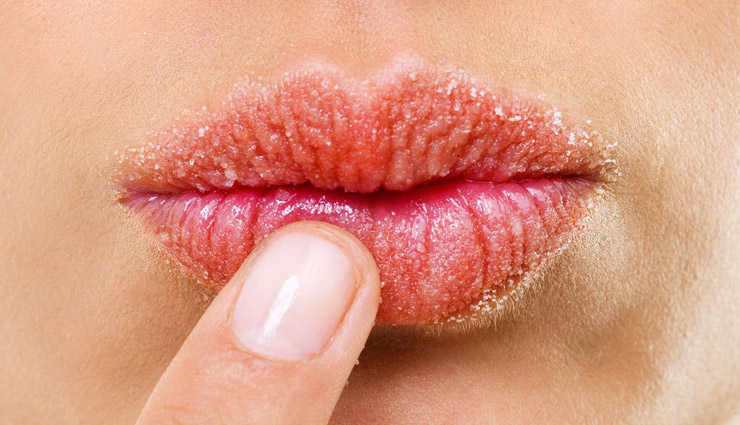 फटे होंठों से छुटकारा दिलाएँगे ये बेहतरीन तरीके, मिनटों में तैयार होंगे घर पर ही