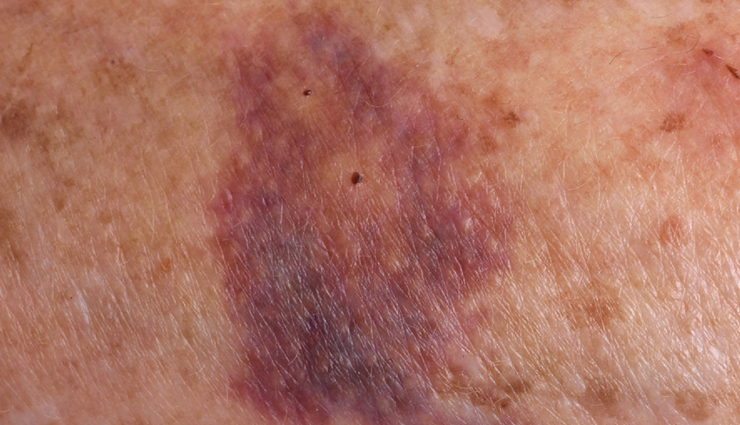 coconut oil benefits for face,facial benefits of coconut oil,using coconut oil for facial care,coconut oil advantages for skin,coconut oil face treatment benefits,benefits of applying coconut oil on face,coconut oil and facial skincare benefits,coconut oil for face glow,coconut oil for facial moisturization,coconut oil and skin health advantages