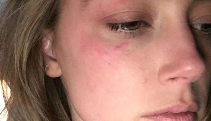 watermelon skin benefits,hydration for skin,antioxidants in watermelon,soothing skin irritation,exfoliating properties of watermelon,brightening skin with watermelon,moisturizing and nourishing effects,sun protection from lycopene,natural skincare with watermelon,watermelon skincare routine,skin hydration tips,anti-inflammatory skincare,skin exfoliation methods,vitamin-rich skincare,protecting skin from uv damage,cleansing with natural ingredients