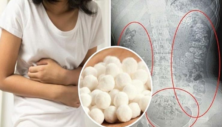 अचानक उठा 14 साल की लड़की के पेट में भयानक दर्द, सीटी स्कैन में हुआ चौंका देने वाला खुलासा