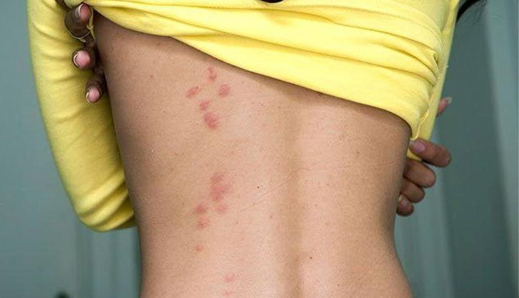 benefits of banana peel,health benefits of banana peel,banana peel for skin,banana peel for weight loss,banana peel oral health,banana peel uses,banana peel nutrition