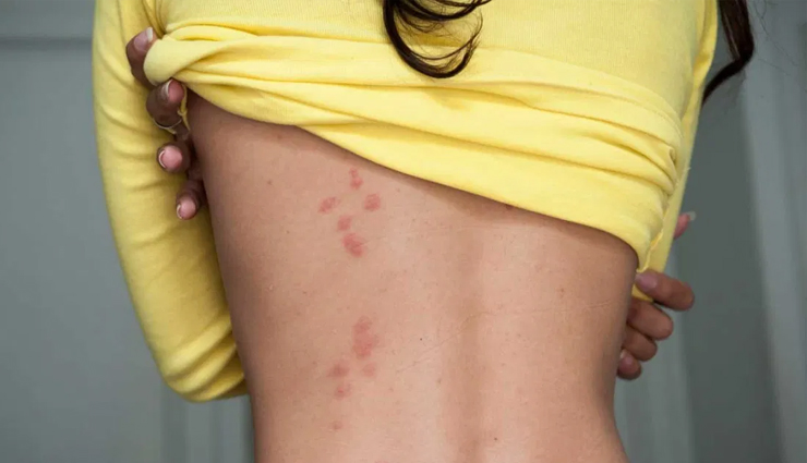 health benefits of activated charcoal,activated charcoal,activated charcoal health benefits,activated charcoal good for health,Health tips,healthy living