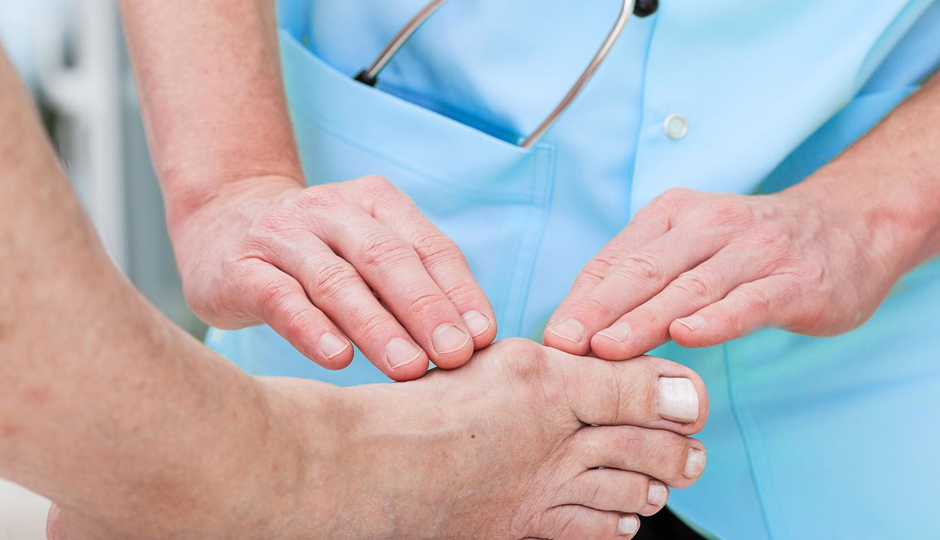 bunion causes,bunion treatment,bunion pain relief,foot deformities,non-surgical bunion remedies,bunion prevention,flat feet and bunions,hammertoe,foot care tips,bunion management,arthritis and bunions,inherited foot type,bunion exercises,bunion discomfort