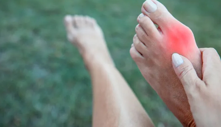 home remedies for bunions,treat bunions naturally,bunion pain relief,natural treatments for bunions,bunion home remedies,bunion treatment without surgery,bunion exercises,reduce bunion swelling,managing bunions at home,bunion care tips,effective bunion remedies,bunion relief solutions,pain management for bunions,bunion prevention,remedies for foot discomfort