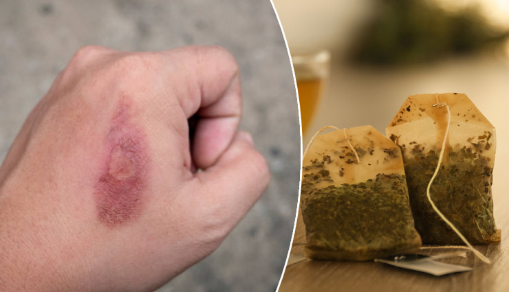 home remedies for skin problems,natural remedies for skin,treat skin issues at home,effective skin care remedies,oily skin treatment,dry skin remedies,anti-aging skin care,pimple and acne treatment,skin burn remedies,blackheads and whiteheads removal,unwanted hair removal,damaged skin healing