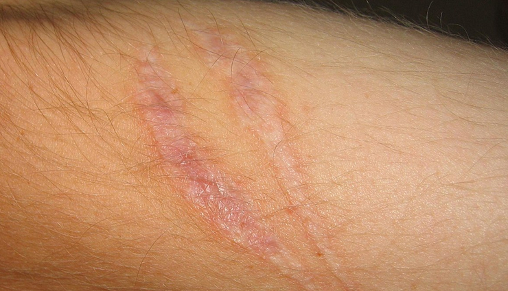 moringa oil,moringa oil beauty benefits,beauty benefits of moringa oil,moringa oil for skin,moringa oil for hair,moringa oil for skin and hair,beauty,beauty tips,skin care tips