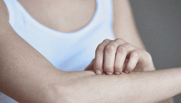5 Remedies To Treat Burning Sensation on Your Skin
