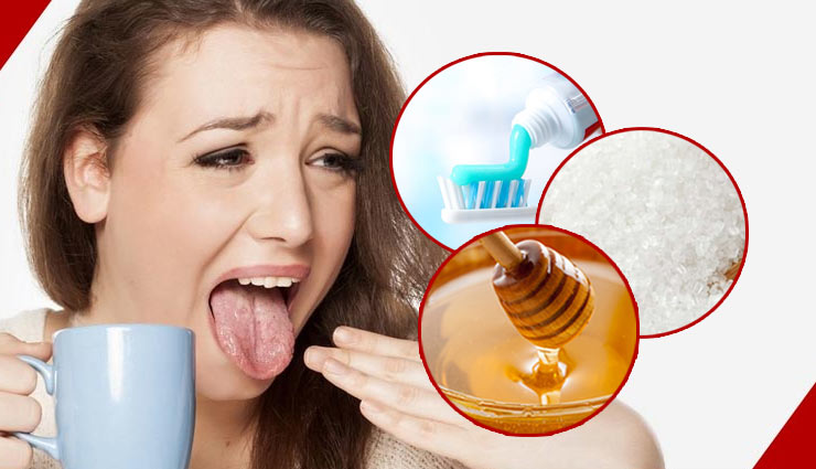 गर्म खानपान से जीभ का जलना पीड़ादायक, इन उपायों से मिलेगी मिनटों में राहत 