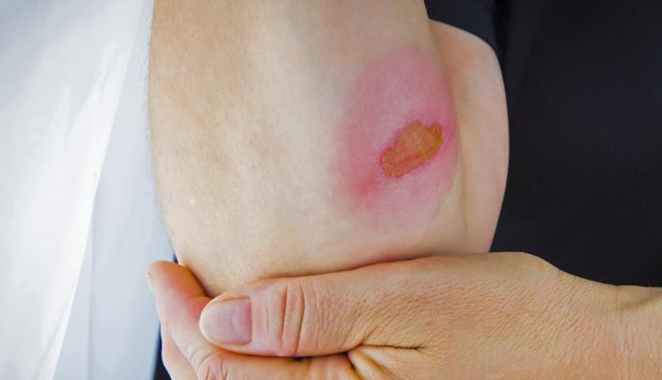 glycerin beauty benefits,glycerin for skin and hair,beauty uses of glycerin,glycerin in skincare,hair benefits of glycerin,glycerin for beauty regimen,glycerin cosmetic benefits,glycerin in beauty products,natural glycerin benefits,glycerin beauty hacks