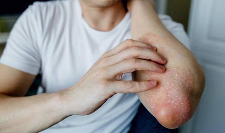 major causes of butt itching,Health,healthy living