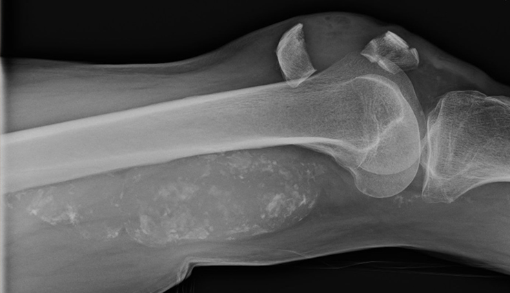 palak,health benefits of eating palak,world vegan day,benefits of spinach,spinach for good health,healthy food spinach,health news,health news in hindi,healthy living