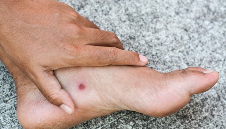 side effects of using camphor,camphor on health,Health tips,fitness tips