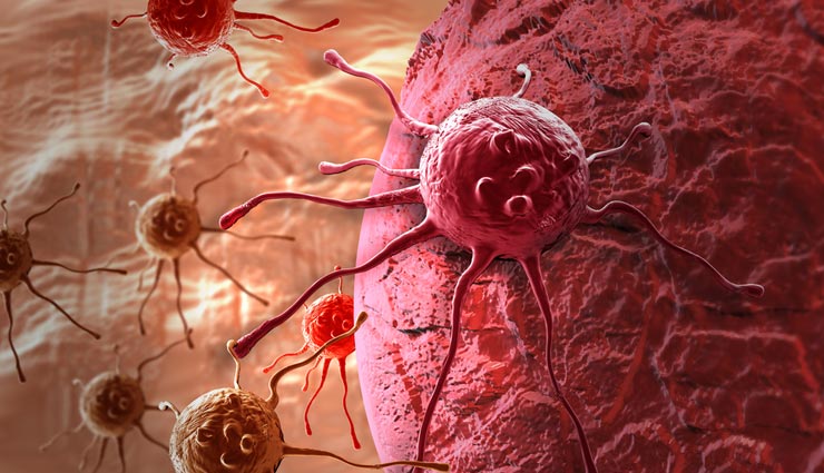 Cancer Day - How Cancer is Diagnosed by Professionals?