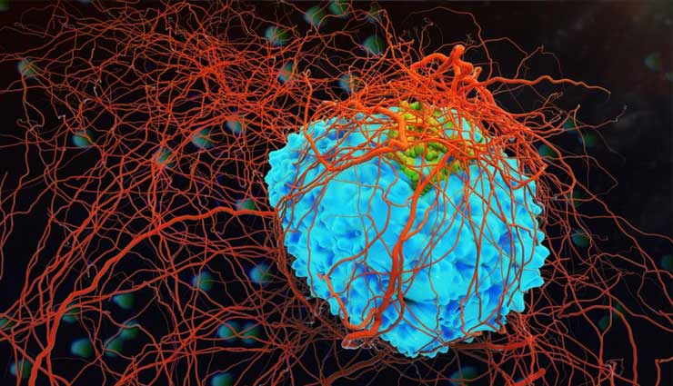 World Cancer Day 2019: इजरायली कंपनी का दावा, अब कैंसर का हो सकेगा 100 प्रतिशत इलाज