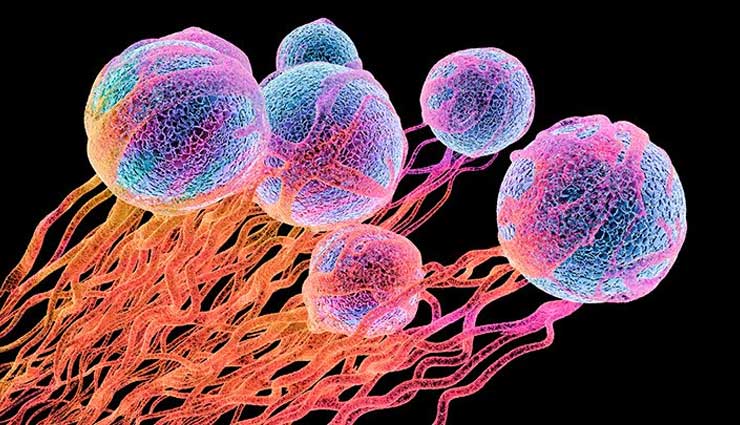 World Cancer Day 2019: इस तरह शरीर में फैलता है जानलेवा कैंसर, ये होती है चार स्टेज, कुछ कारगर घरेलू उपाय 