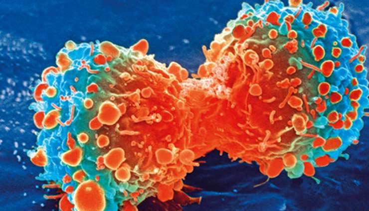 cancer,cancer symptoms,symptoms of cancer,what is cancer in hindi,signs of cancer,Health,Health tips