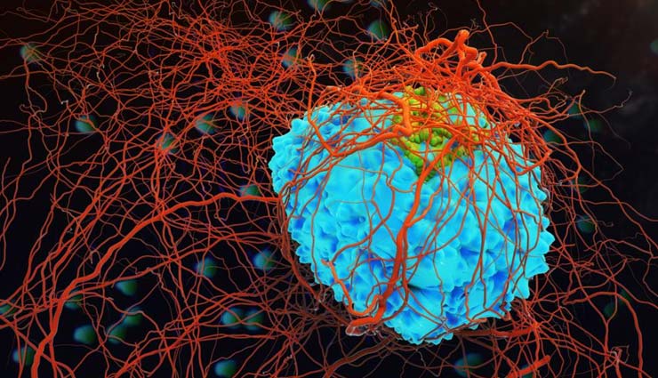 कैंसर बन रहा हैं बड़ा अभिशाप, इन संकेतों को ना करें नजरअंदाज 