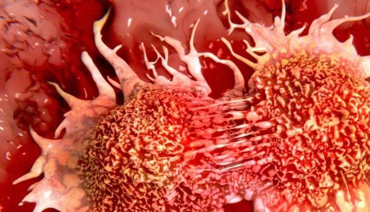 cancer,cancer in hindi,symptoms of cancer,signs of cancer,warning signs of cancer,early signs of cancer,warning signs of cancer,Health,health tips in hindi