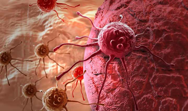 मौत के बड़े कारणों में से एक हैं कैंसर की बीमारी, इन आहार से करें खुद को सुरक्षित 