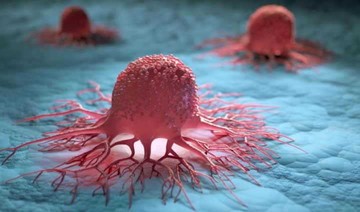 6 Foods That Causes Cancer and You Must Avoid Them