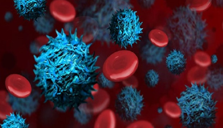 ऋषि कपूर को था ये खतरनाक कैंसर, जिसकी वजह से हुई मौत why rishi kapoor died,which cancer have rishi kapoor,which cancer have actor rishi kapoor,what is leukemia cancer,what is leukemia,what is cancer,treatment of leukemia cancer,symptoms leukemia cancer,risk factors of leukemia cancer,rishi kapoor death reason hindi,rishi kapoor death reason,rishi kapoor news,Health,health news