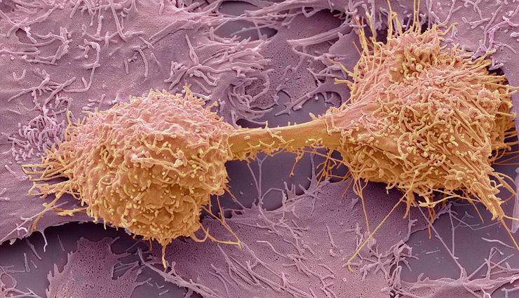 microscopic pictures,the amazing world through microscope