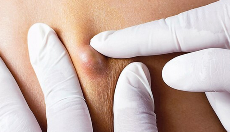 do not ignore these early symptoms of cancer,negligence can be heavy,Health,healthy living