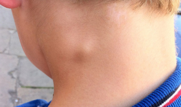 ये संकेत दिखते ही हो जाएं सतर्क, करते हैं पेट के कैंसर का इशारा stomach cancer warning signs,recognizing stomach cancer symptoms,early signs of gastric cancer,health alert for stomach cancer,identifying stomach cancer indicators,be vigilant for stomach cancer symptoms,signs of gastric cancer to watch for,awareness of stomach cancer symptoms,detecting stomach cancer early,health tips for recognizing gastric cancer,red flags for stomach cancer,knowing the signs of stomach cancer,stomach cancer awareness and prevention,stomach cancer symptoms and health vigilance,promoting healthy living and cancer awareness