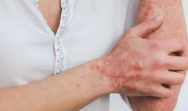 ये संकेत दिखते ही हो जाएं सतर्क, करते हैं पेट के कैंसर का इशारा stomach cancer warning signs,recognizing stomach cancer symptoms,early signs of gastric cancer,health alert for stomach cancer,identifying stomach cancer indicators,be vigilant for stomach cancer symptoms,signs of gastric cancer to watch for,awareness of stomach cancer symptoms,detecting stomach cancer early,health tips for recognizing gastric cancer,red flags for stomach cancer,knowing the signs of stomach cancer,stomach cancer awareness and prevention,stomach cancer symptoms and health vigilance,promoting healthy living and cancer awareness