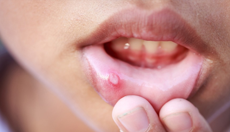 aloe vera,aloe vera health benefits,aloe vera healthy food,healthy food aloe vera,Health,healthy tips,healthy food