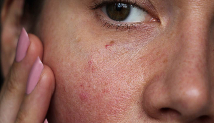 beauty benefits of using blueberries,blue berries benefits,beauty tips,beauty hacks