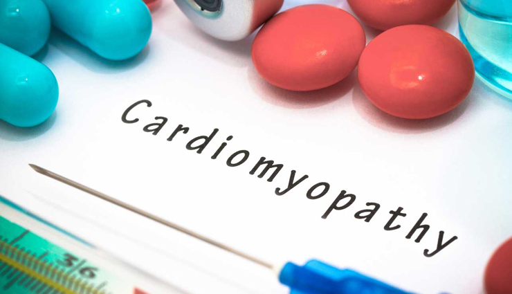 heart diseases,different type of heart diseases,heart care tips,heart care,heart condition,illness of heart,Health,Health tips