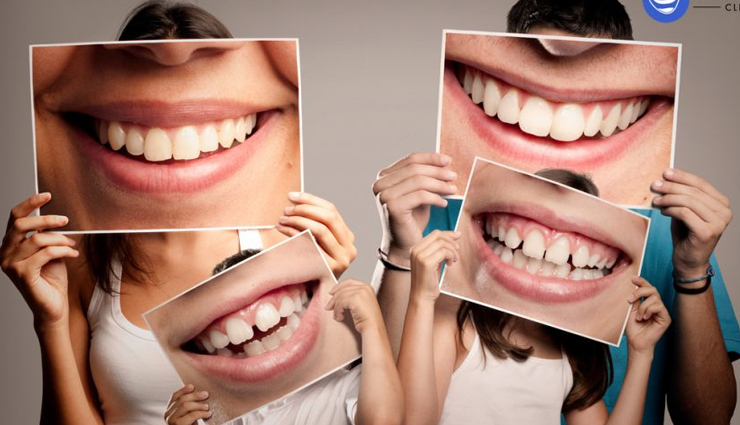 cardamom,health benefits of cardamom,Health tips,fitness tips