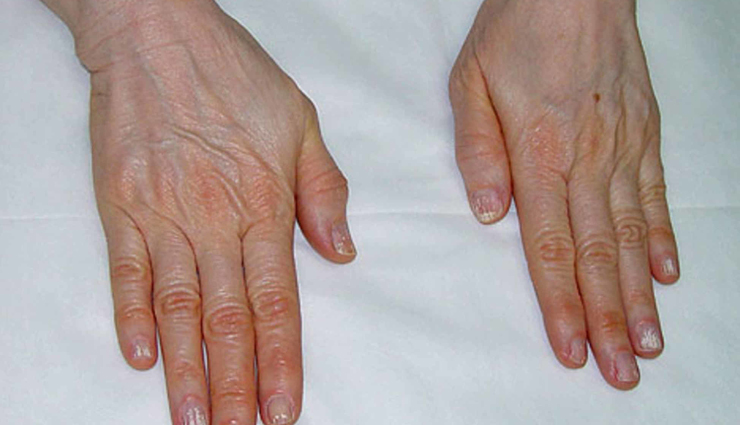 carrots,health benefits of eating carrots,Health tips,fitness tips