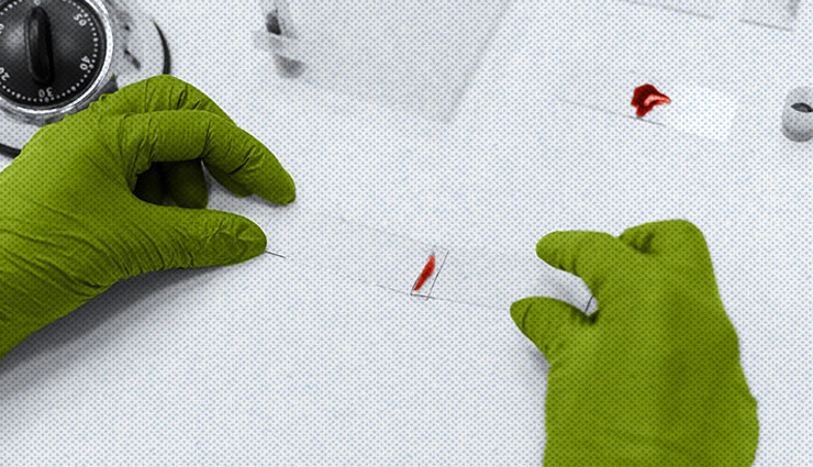 cashew milk,health benefits of cashew milk,Health tips,fitness tips