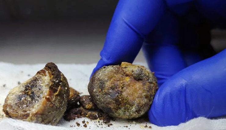 cashew nuts,health benefits of cashew nuts,Health tips,fitness tips