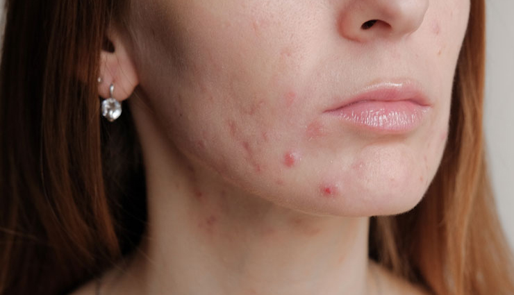 castor oil,health benefits of castor oil,Health tips,fitness tips