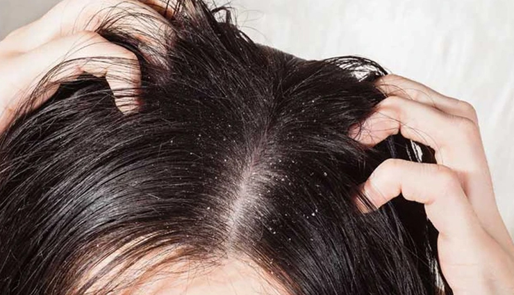 castor oil,castor oil for hair growth,hair care tips,beauty tips