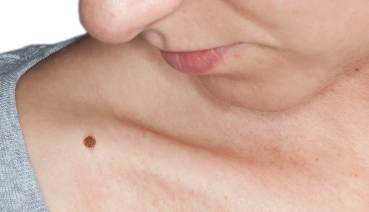 castor oil,health benefits of castor oil,Health tips,fitness tips