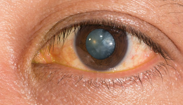 आपकी कई परेशानियों का हल बन सकता हैं आंवला, जानें इससे मिलने वाले फायदे amla,amla health benefits,healthy food amla,amla for good health,healthy living,Health tips,india gooseberry benefits in hindi