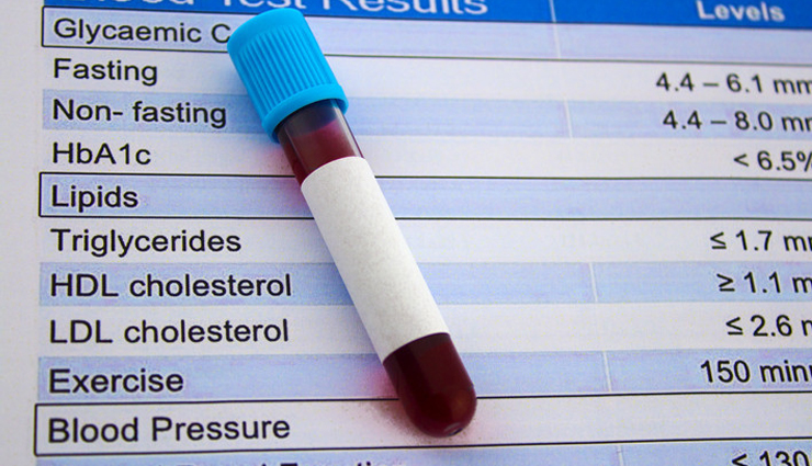 cauliflowers,health benefits of eating cauliflowers,Health tips,fitness tips