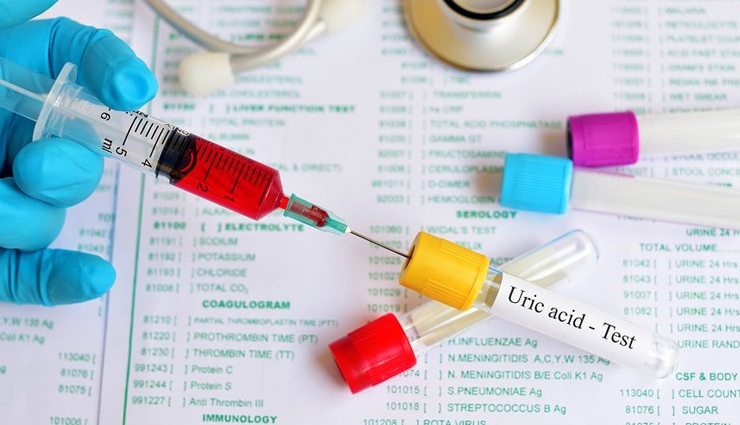 10 Major Causes of High Uric Acid Levels