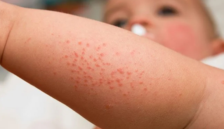 celery,side effects of celery,Health tips,fitness tips