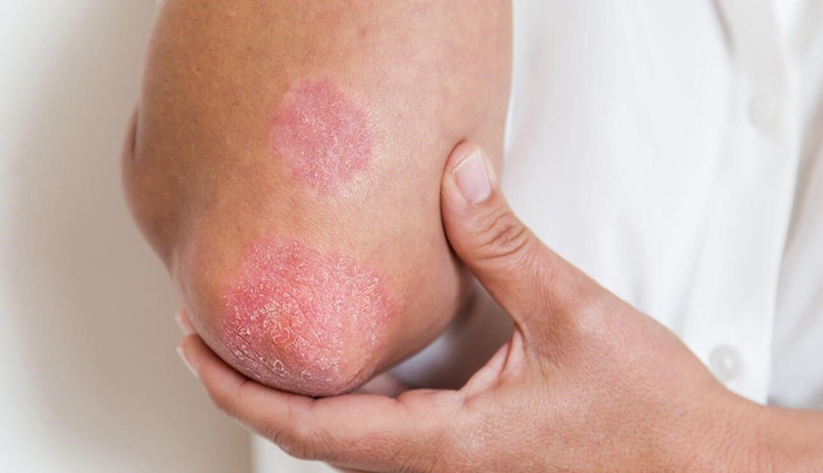 celery,side effects of celery,Health tips,fitness tips