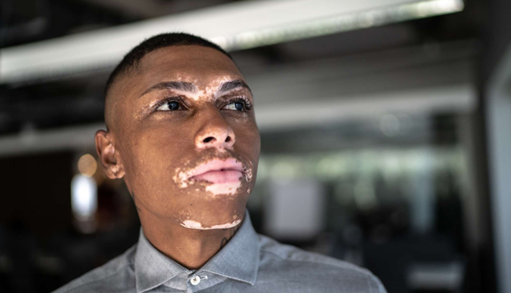 celery,health benefits of celery,Health tips,fitness tips